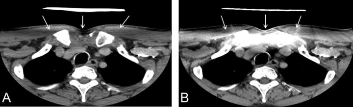 Fig 4.