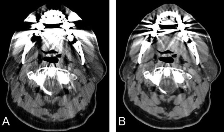 Fig 3.