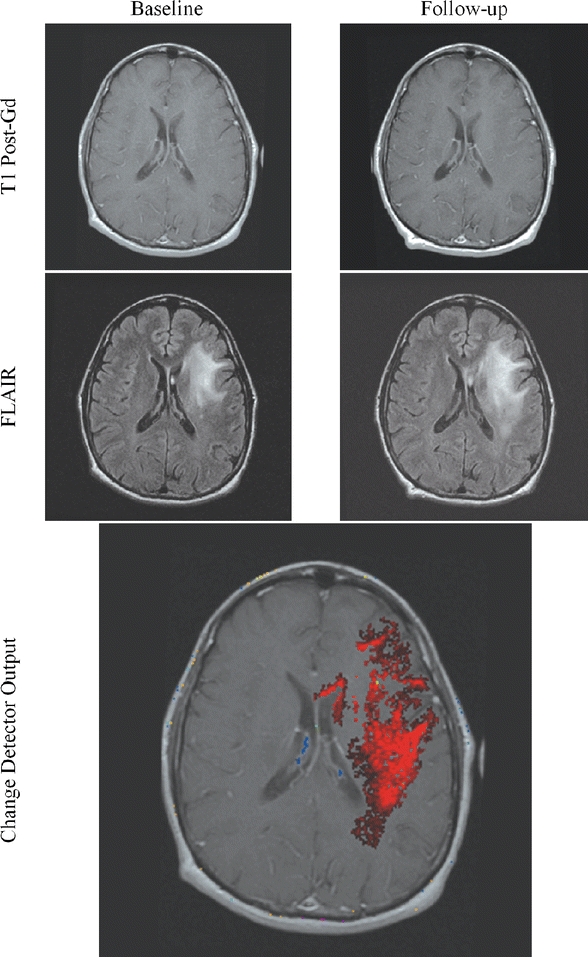 Fig 16