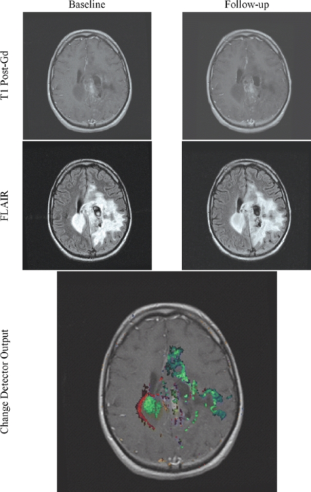 Fig 15