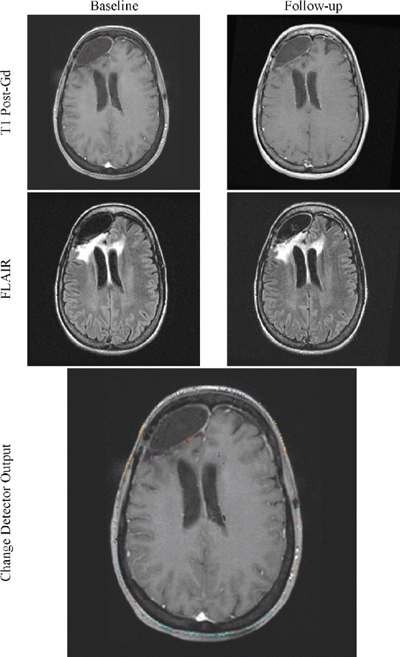 Fig 14