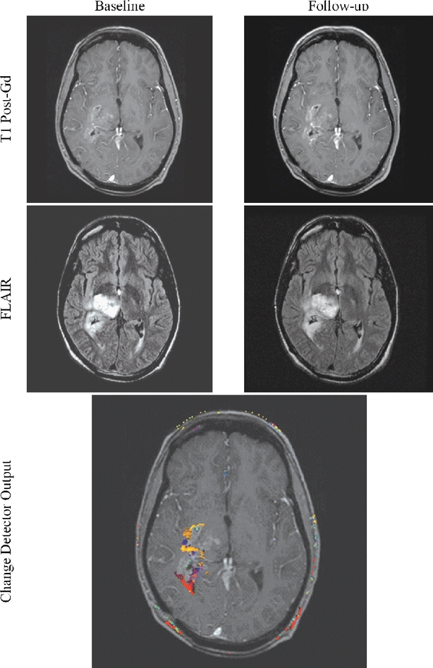 Fig 13