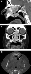 FIG 1