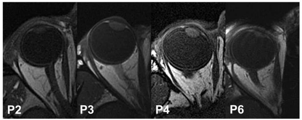 FIGURE 4