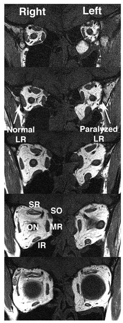 FIGURE 3