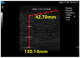 graphic file with name diagnostics-14-00335-i002.jpg