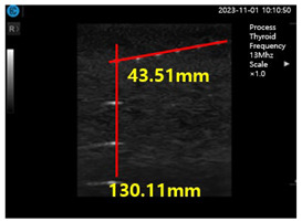 graphic file with name diagnostics-14-00335-i007.jpg