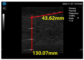 graphic file with name diagnostics-14-00335-i006.jpg