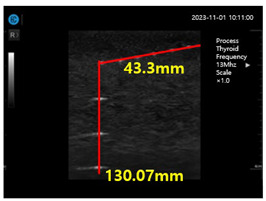 graphic file with name diagnostics-14-00335-i008.jpg