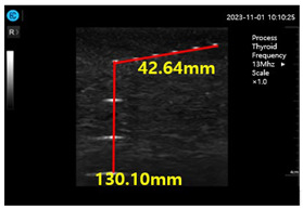 graphic file with name diagnostics-14-00335-i004.jpg