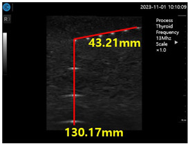 graphic file with name diagnostics-14-00335-i001.jpg