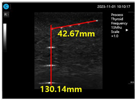 graphic file with name diagnostics-14-00335-i003.jpg