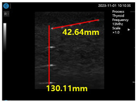 graphic file with name diagnostics-14-00335-i005.jpg