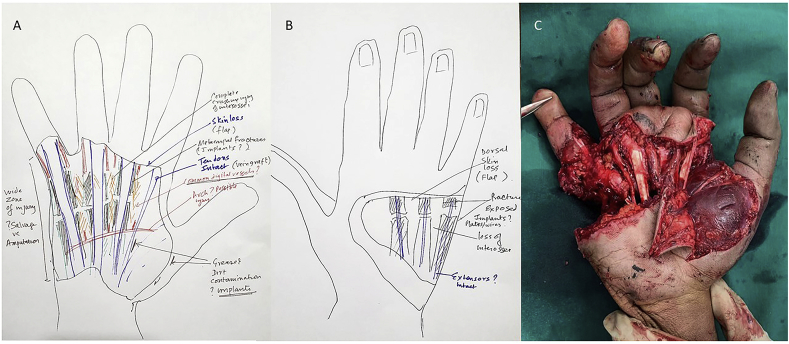 Fig. 2