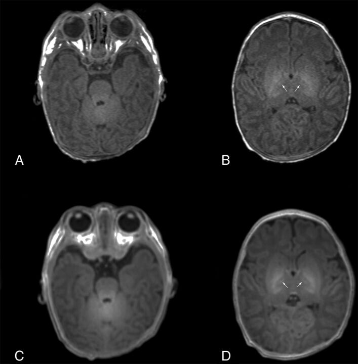 Fig 2.