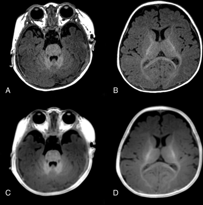 Fig 3.