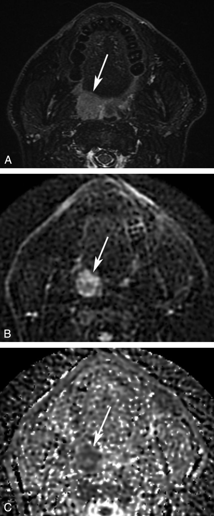 Fig 1.