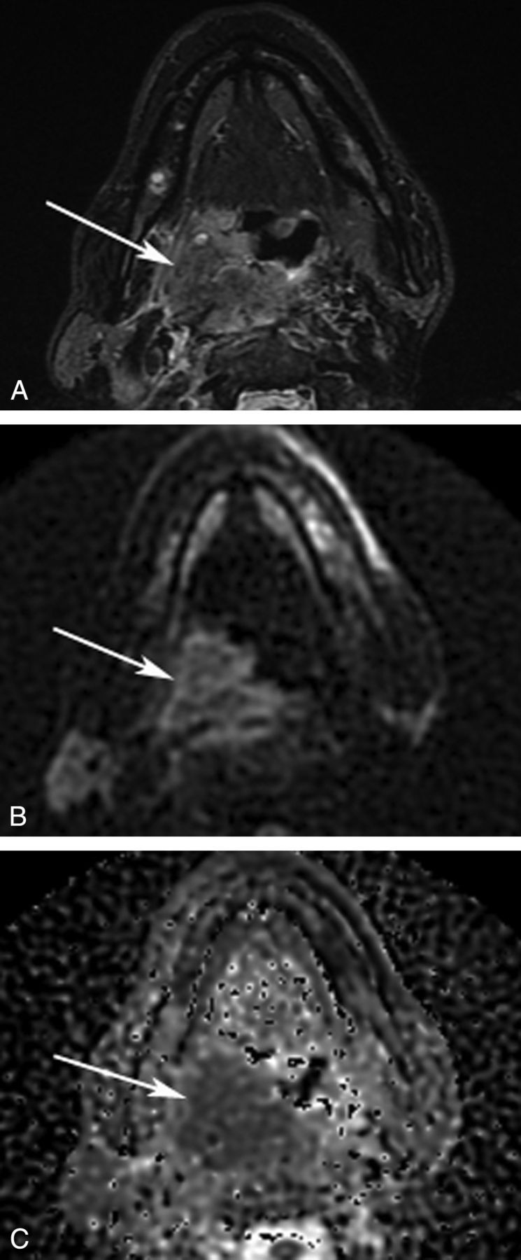 Fig 2.