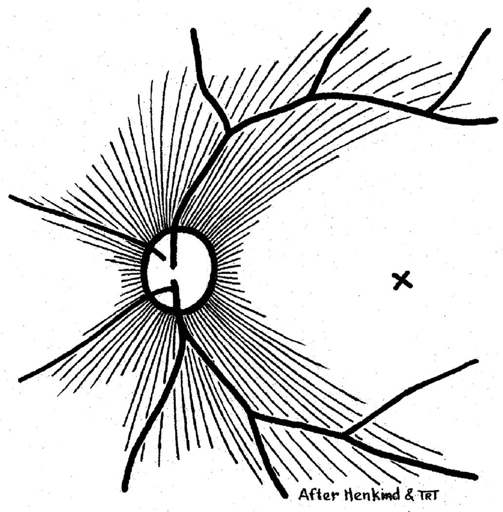 Fig. 30