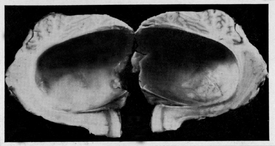 Fig. 17