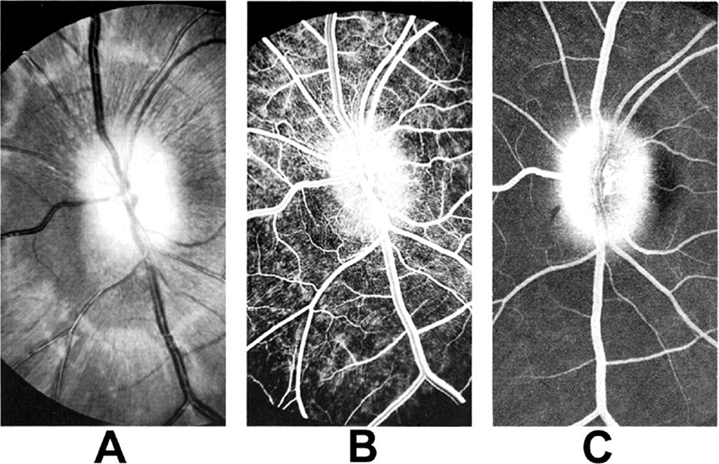 Fig. 29