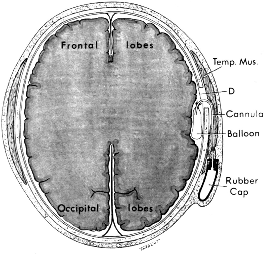 Fig. 14