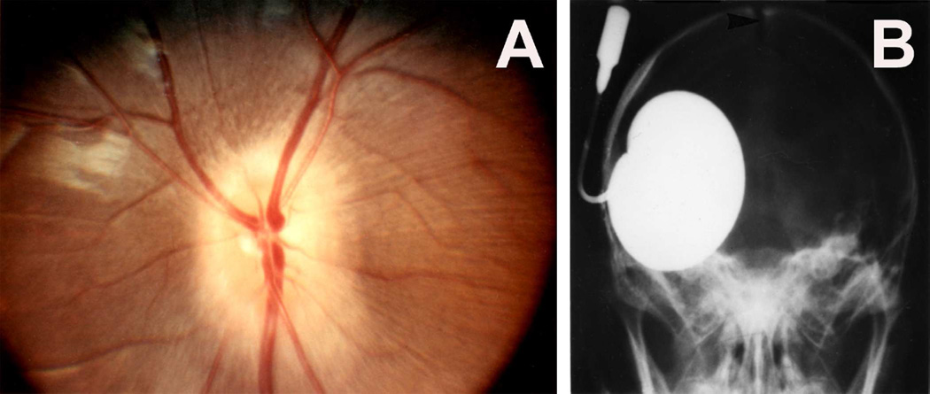 Fig. 23