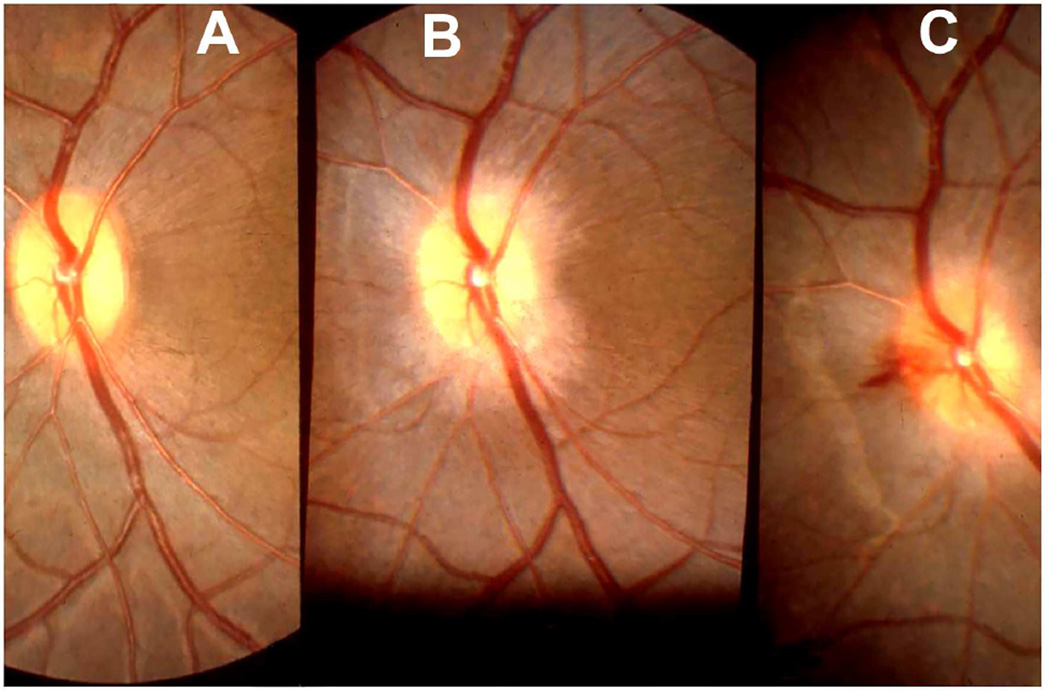 Fig. 22