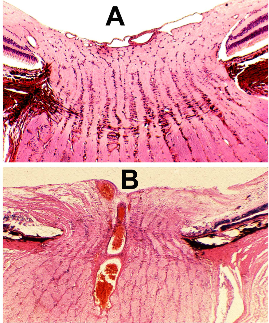 Fig. 35