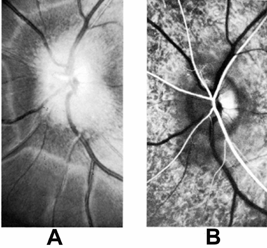 Fig. 28