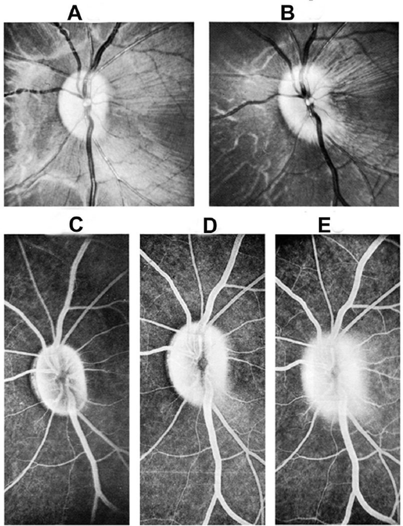 Fig. 26