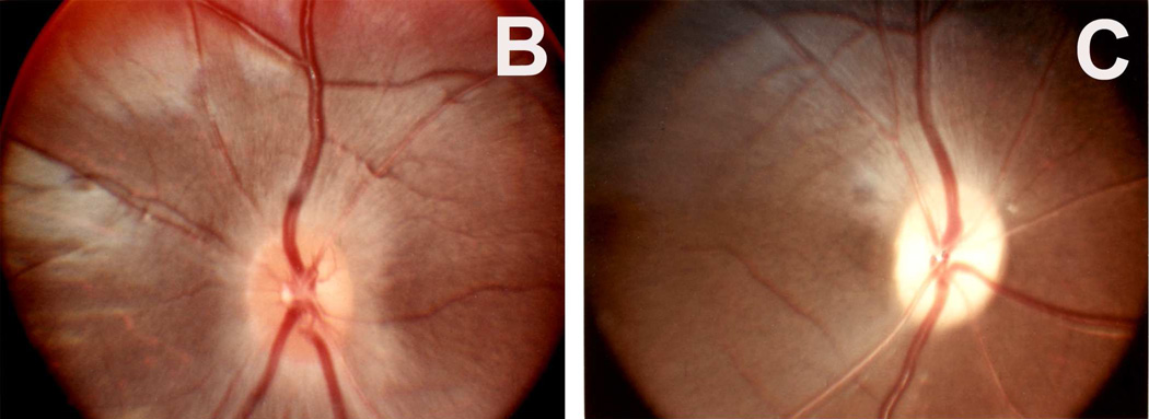 Fig. 9