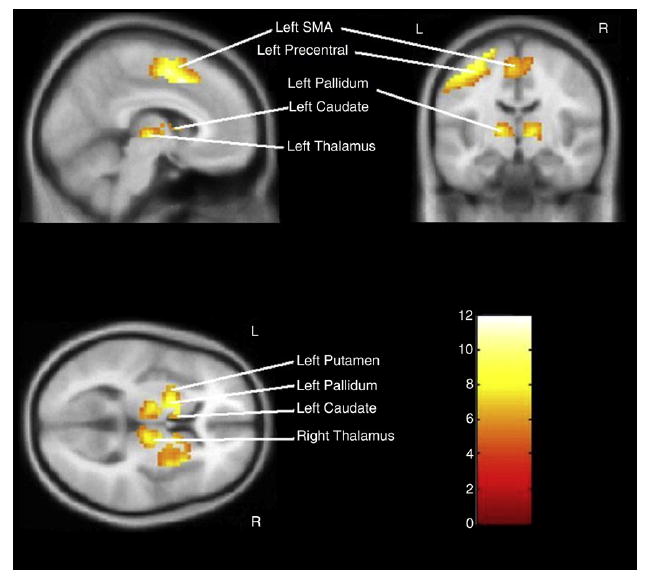 Fig. 2