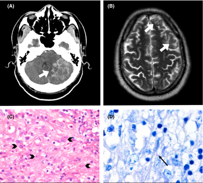 FIGURE 1