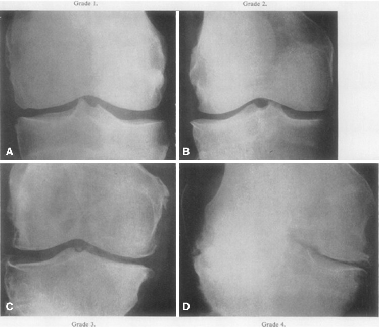 Fig. 1A–D