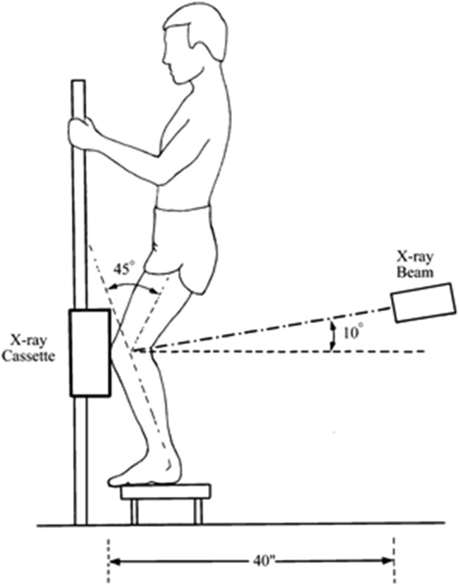 Fig. 2