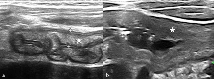 Fig. 14