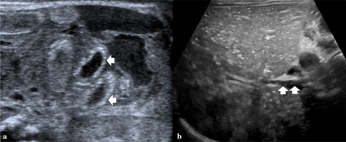 Fig. 13