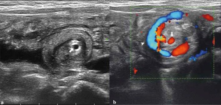 Fig. 5