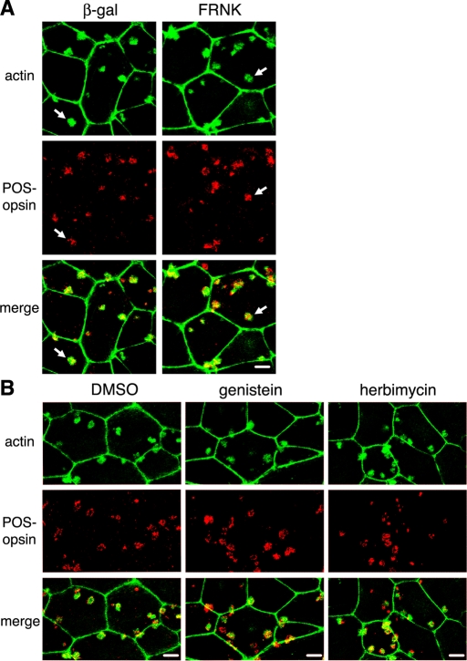 FIGURE 11: