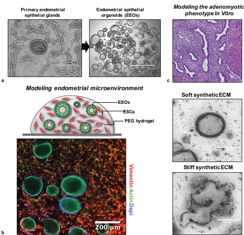 Fig. 3 Development of 3D in vitro models using synthetic hydrogels and endometrial epithelial organoids technologies