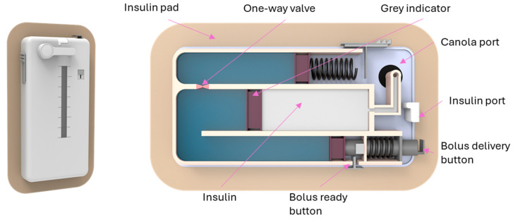 Figure 14