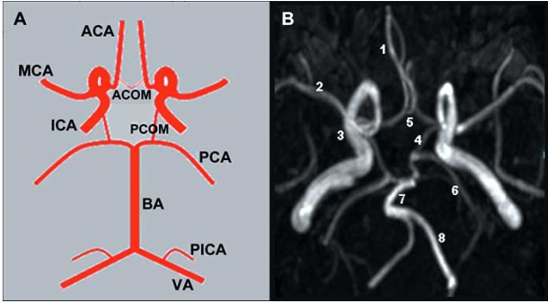 Fig. (1). Cerebral Collateral Circulation.