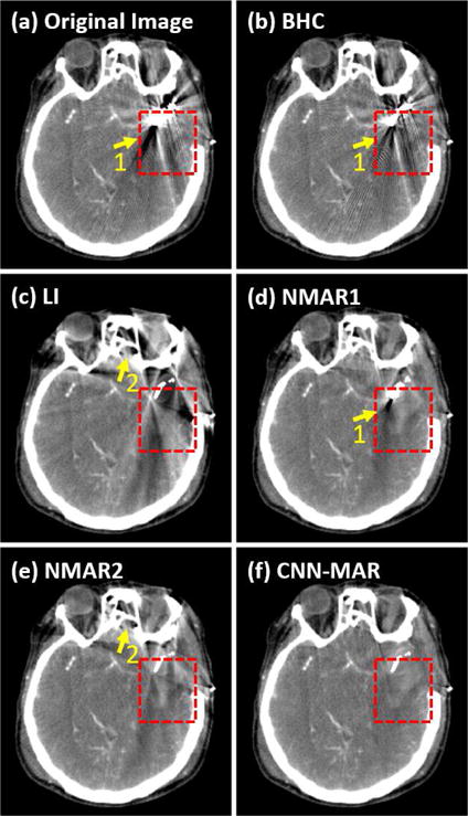 Fig. 11