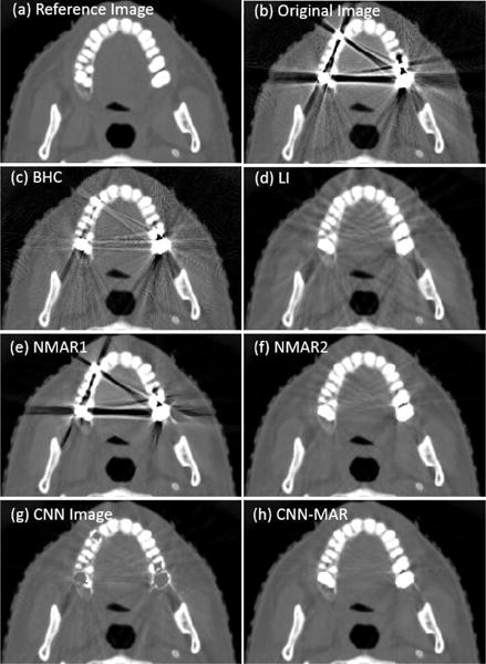 Fig. 10