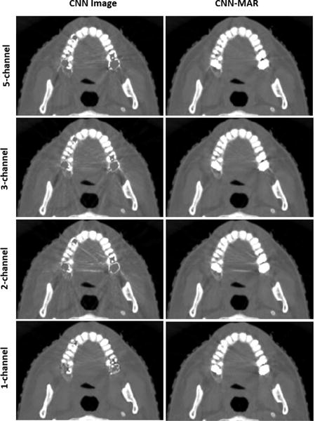 Fig. 13