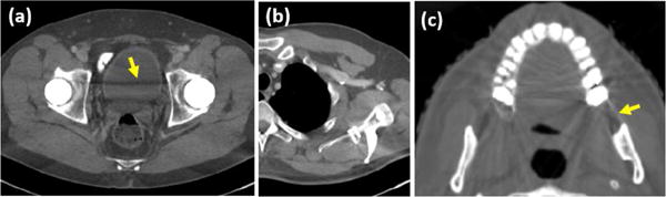 Fig. 12