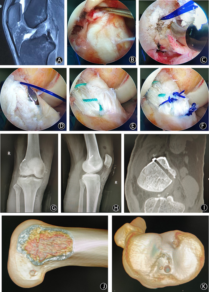 Fig. 6