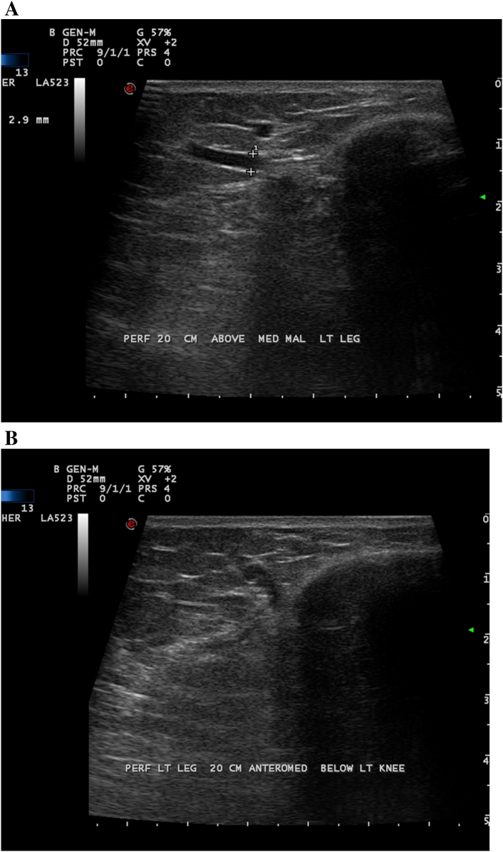 Fig 5