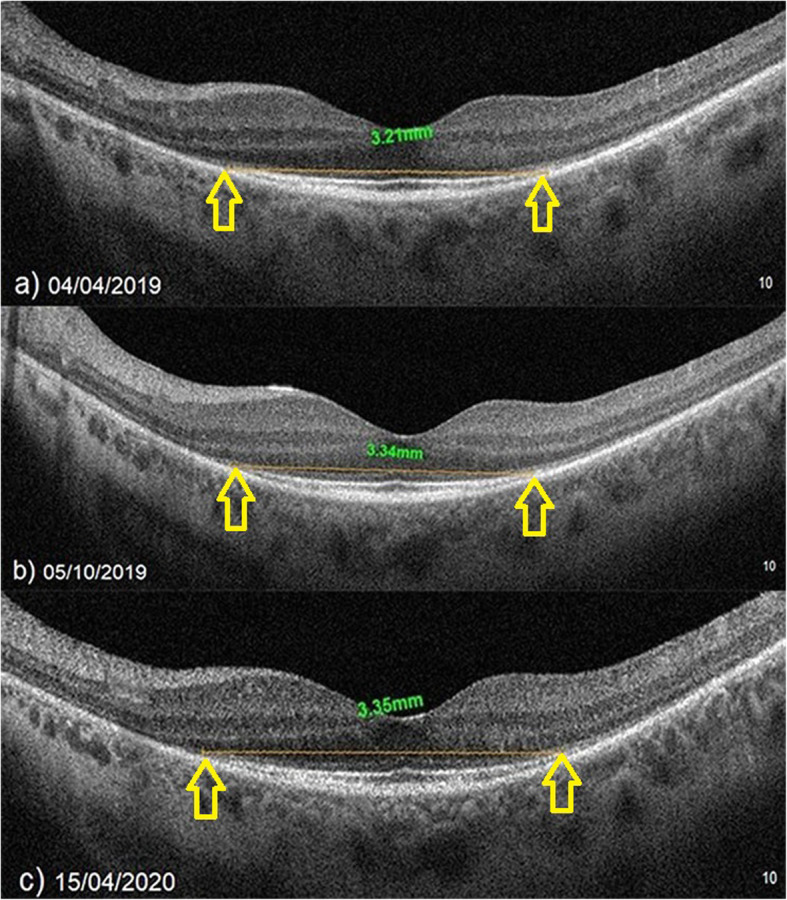 Fig. 6